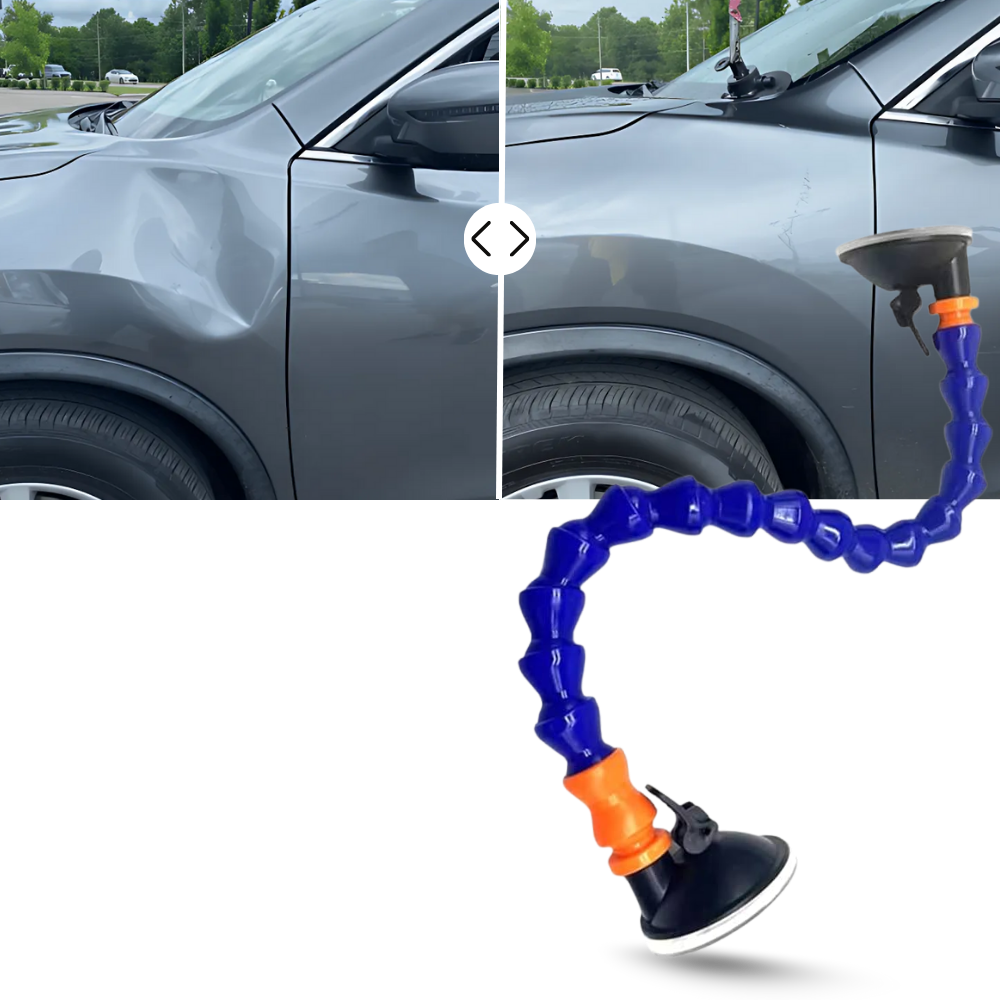 Dent Master Vantuz - Ozerty