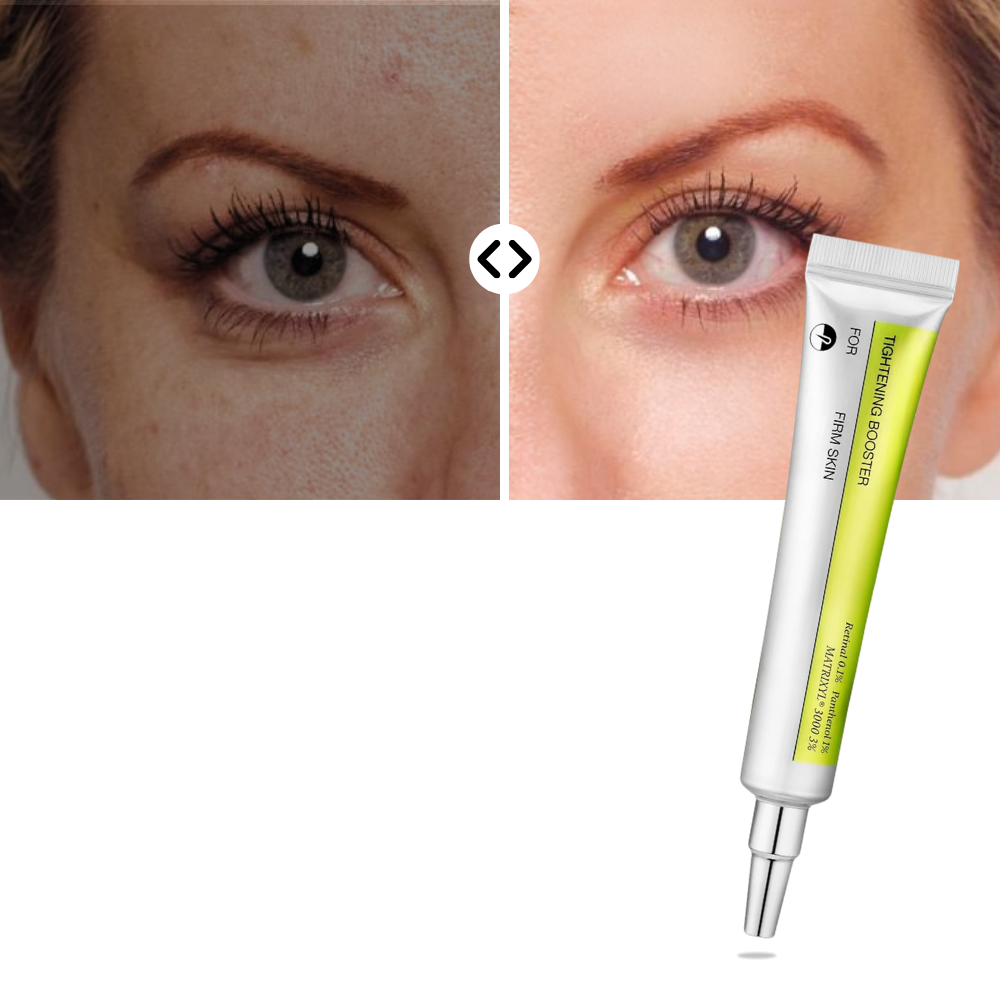 Sıkılaştırıcı Retinal Serum - Ozerty