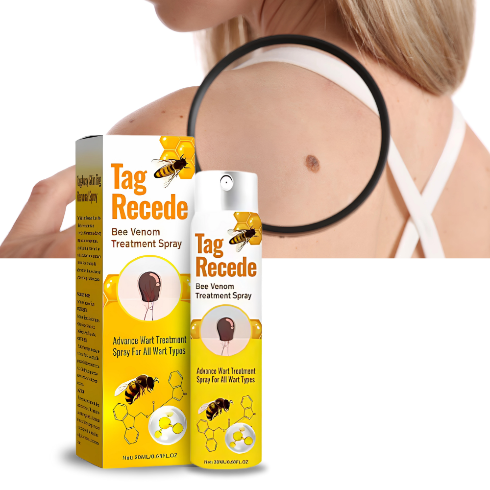 İnvaziv Olmayan Etiket Geri Çekme - Ozerty