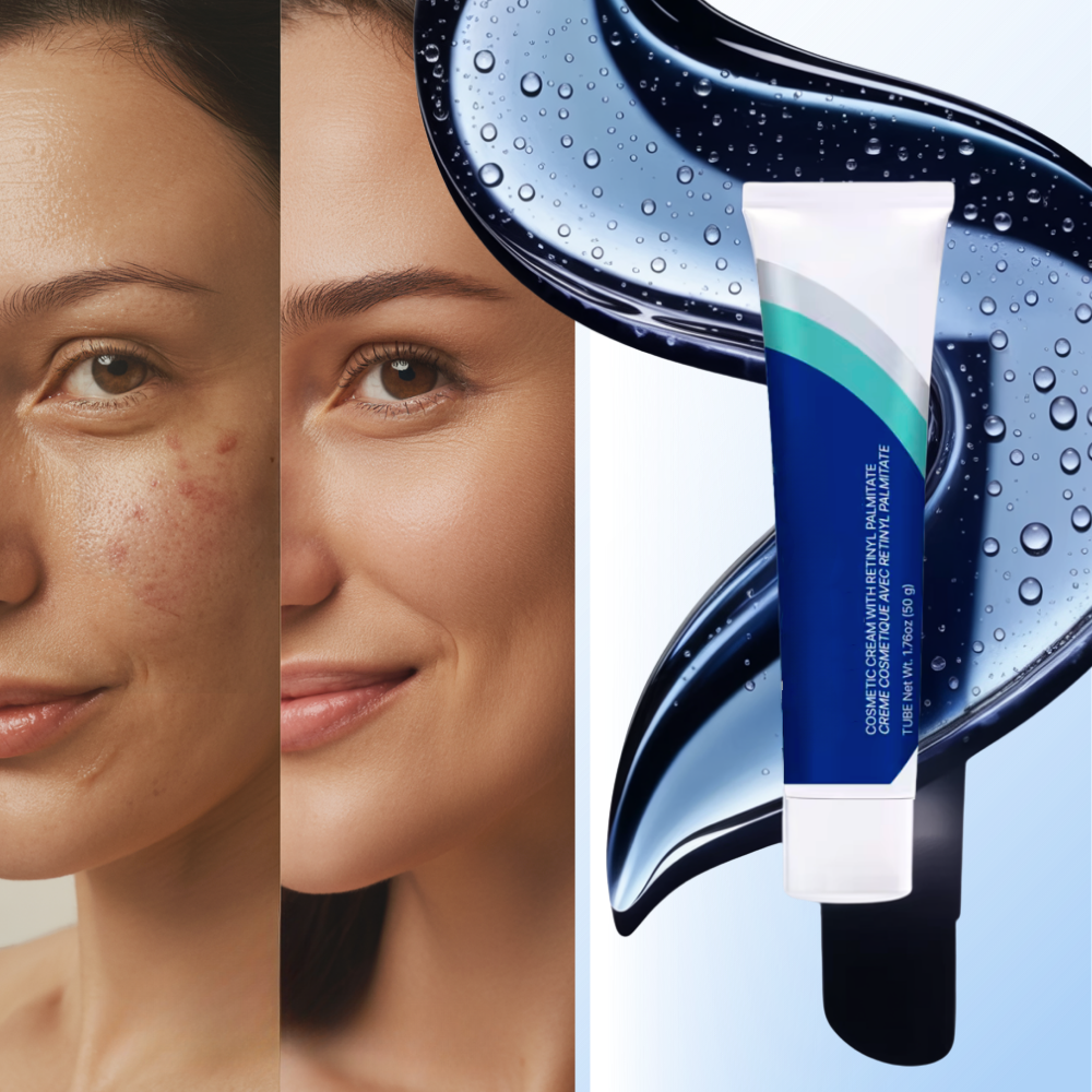 Retinol Cilt Canlandırıcı Krem - Ozerty