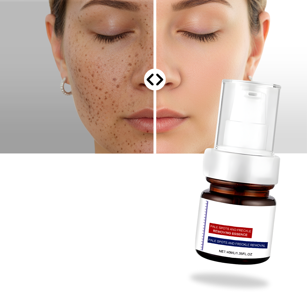 Cilt Aydınlatıcı İpeksi Kojik Serum - Ozerty