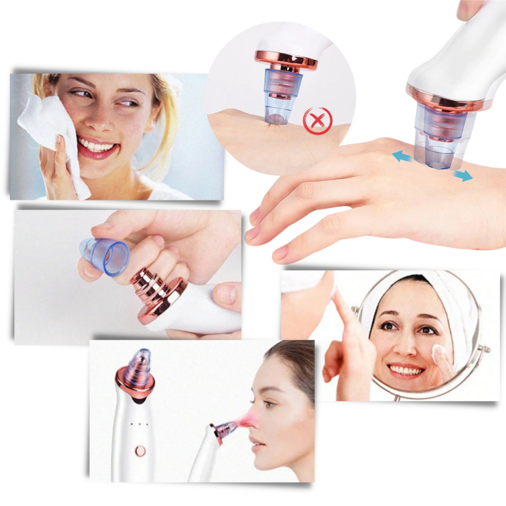 Siyah Nokta Gözenek Çıkarıcı Vakum - Ozerty