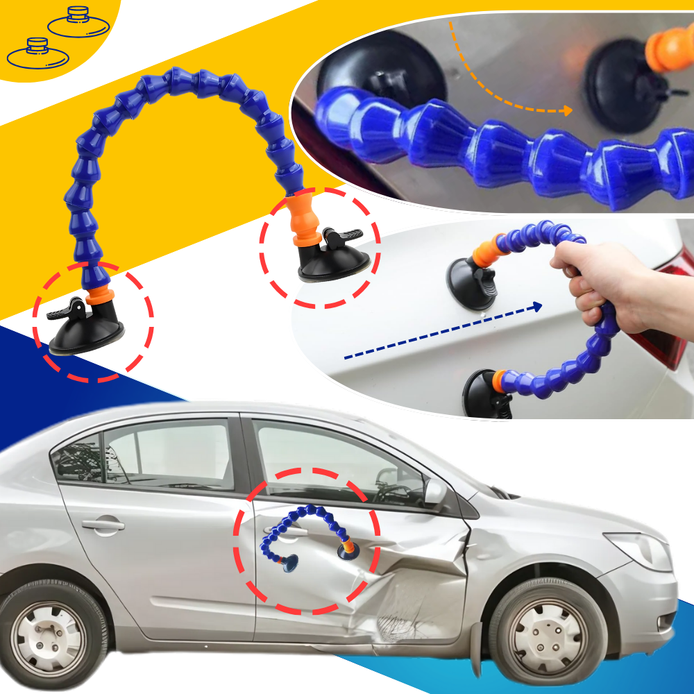 Dent Master Vantuz - Ozerty