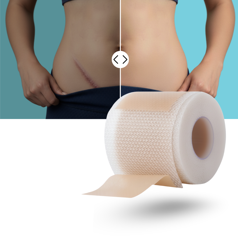 Hyaluronik Silikon Yara Bandı