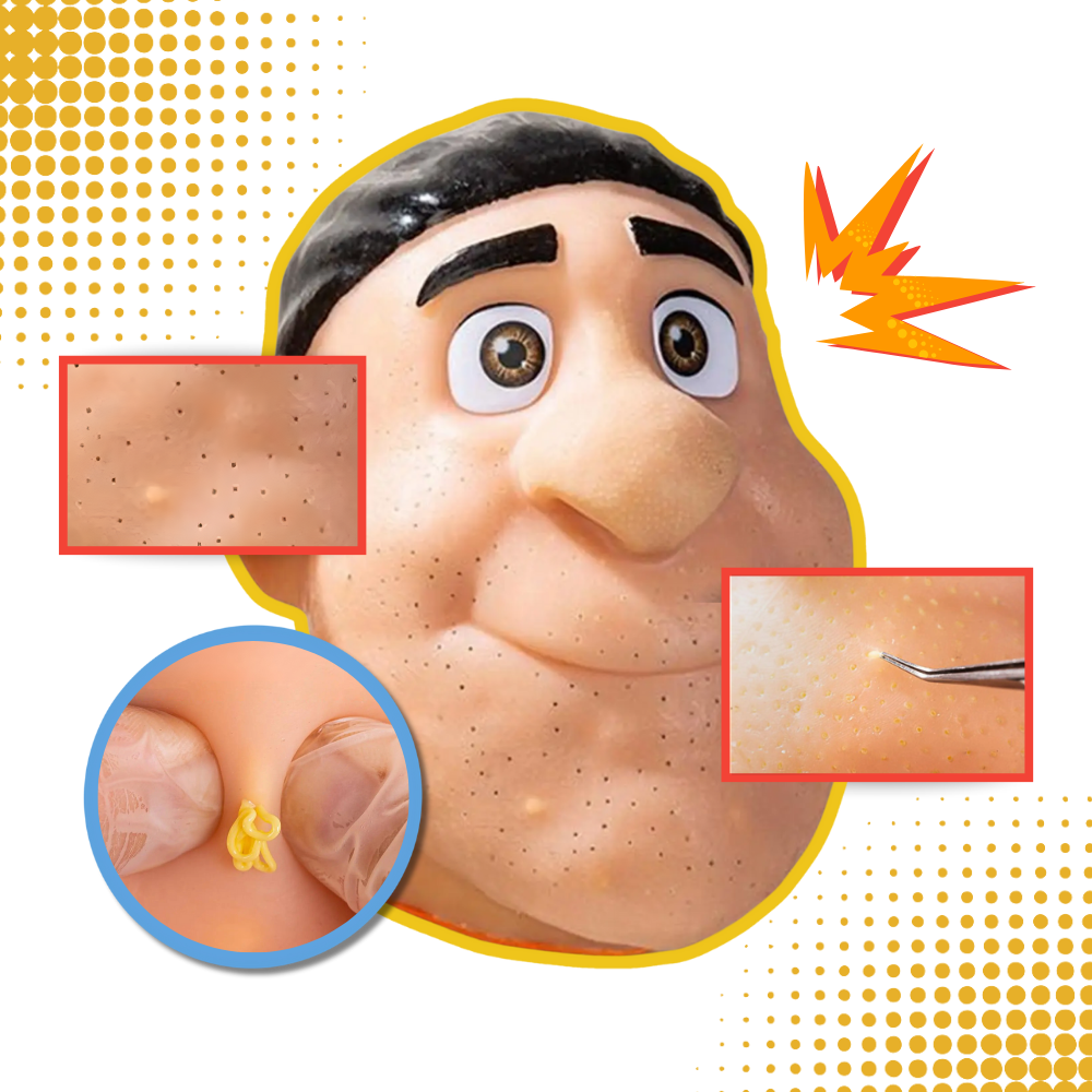 Rahatlatıcı Silikon Sivilce Sıkma Oyuncağı - Ozerty