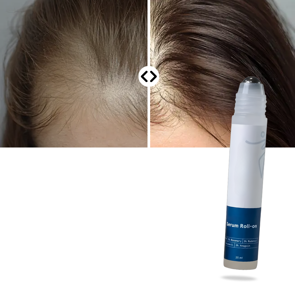 Saç Derisini Besleyen Roll-On Serum - Ozerty