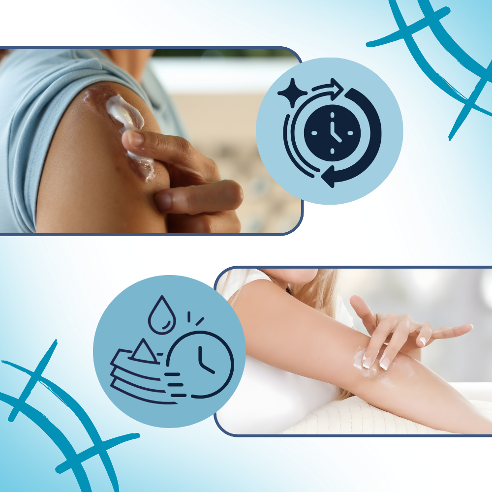 Yara İzi Nemlendirici Silikon Krem - Ozerty