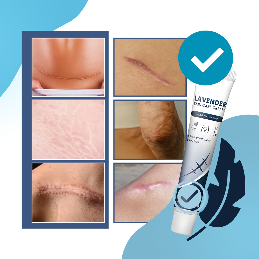 Yara İzi Nemlendirici Silikon Krem - Ozerty