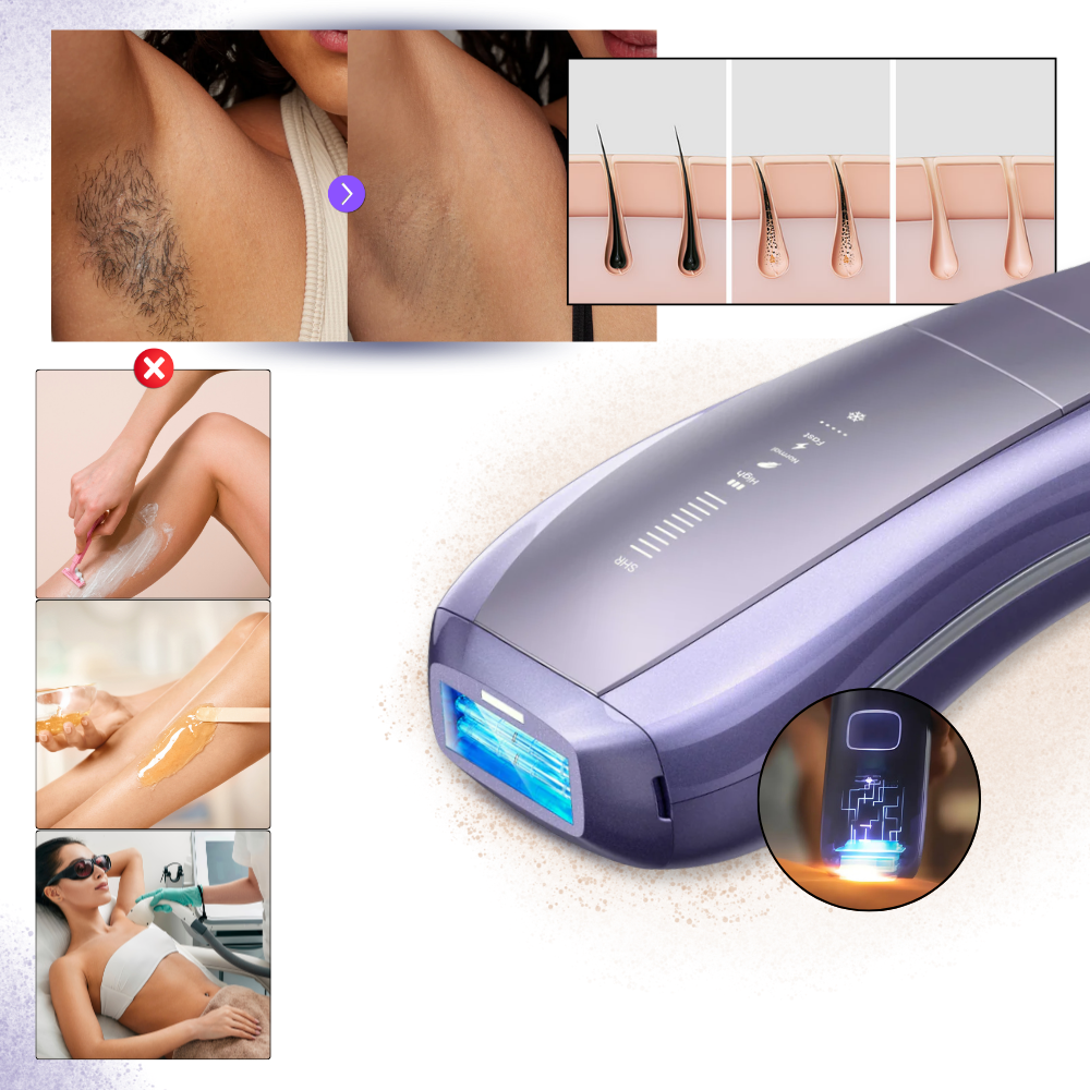 SkinSync Epilasyon Cihazı - Ozerty